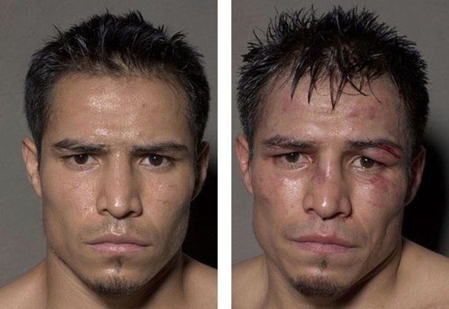 Боксеры после боя (12 фото)