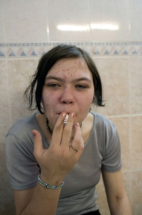 Наркомания в России (42 фото)